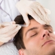Botoxbehandlung der Zornesfalte bei Migräne