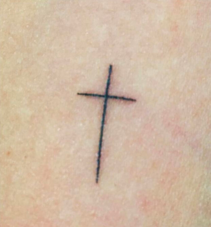 Tattoo Entfernung Wien 1 Tattoo Entfernung Wien 1 Pigmentflecken Entfernen mit Pico Laser in Wien